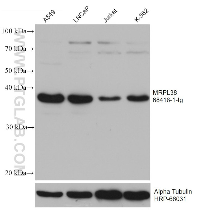 MRPL38 Antibody in Western Blot (WB)
