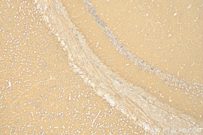 Hexokinase 1 Antibody in Immunohistochemistry (Paraffin) (IHC (P))