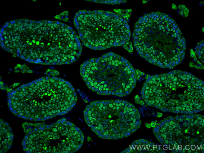 Nesprin 3 Antibody in Immunohistochemistry (PFA fixed) (IHC (PFA))