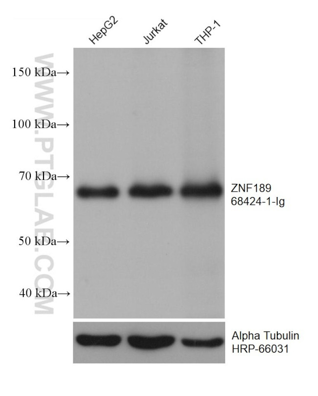 ZNF189 Antibody in Western Blot (WB)