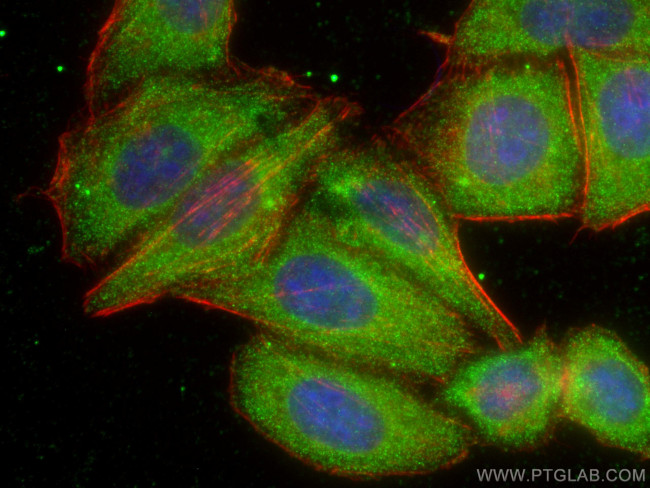 ATP6V1H Antibody in Immunocytochemistry (ICC/IF)