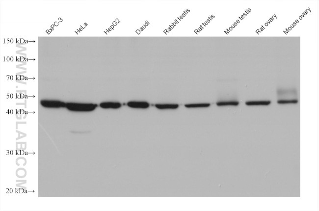 ZNF174 Antibody in Western Blot (WB)