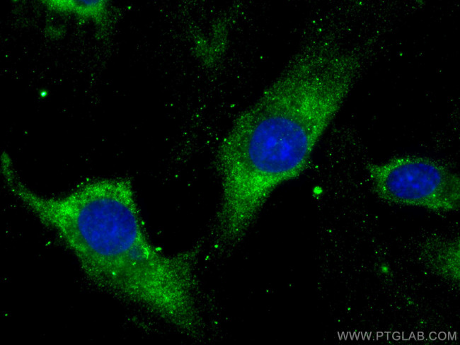 ARP3/ARP3B Antibody in Immunocytochemistry (ICC/IF)