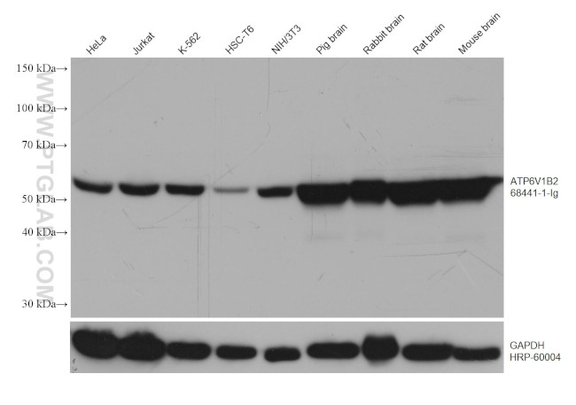 ATP6V1B2 Antibody in Western Blot (WB)