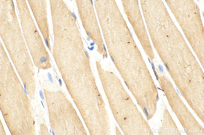 ULK1 Antibody in Immunohistochemistry (Paraffin) (IHC (P))