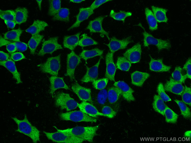 FBP1 Antibody in Immunocytochemistry (ICC/IF)