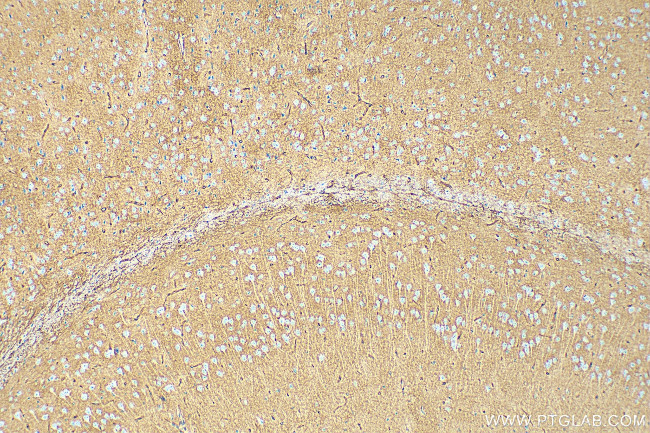 Aquaporin 4 Antibody in Immunohistochemistry (Paraffin) (IHC (P))