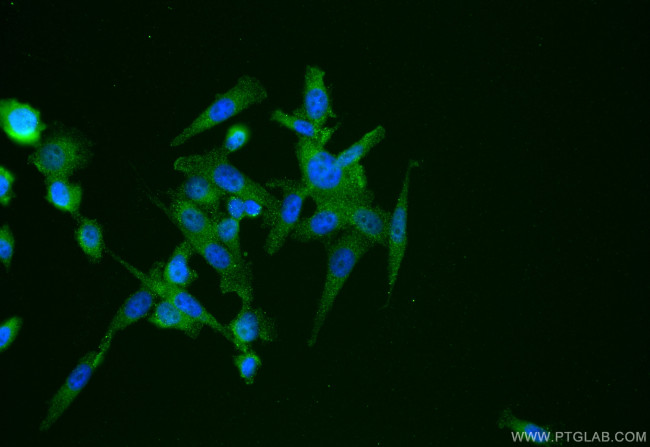 OTUD6B Antibody in Immunocytochemistry (ICC/IF)