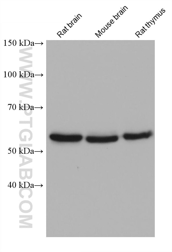 CAMK4 Antibody in Western Blot (WB)