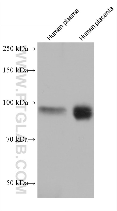 FBLN1 Antibody in Western Blot (WB)