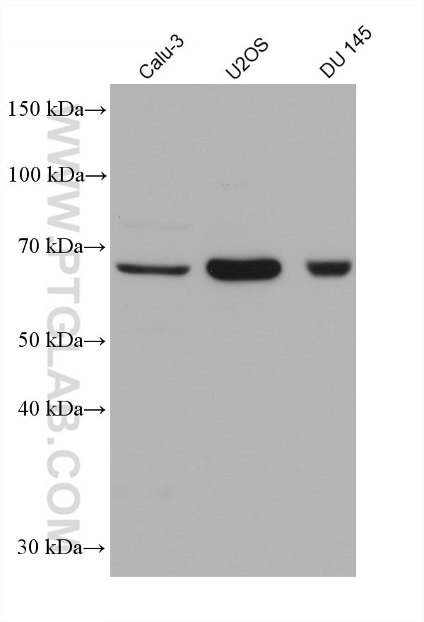 DDX43 Antibody in Western Blot (WB)