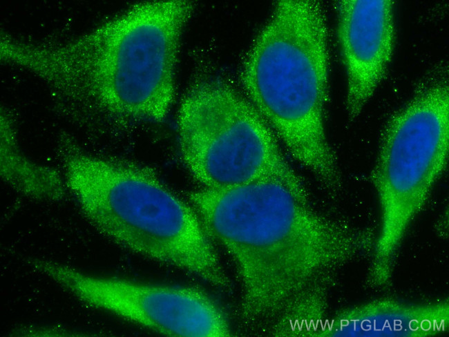 SQRDL Antibody in Immunocytochemistry (ICC/IF)