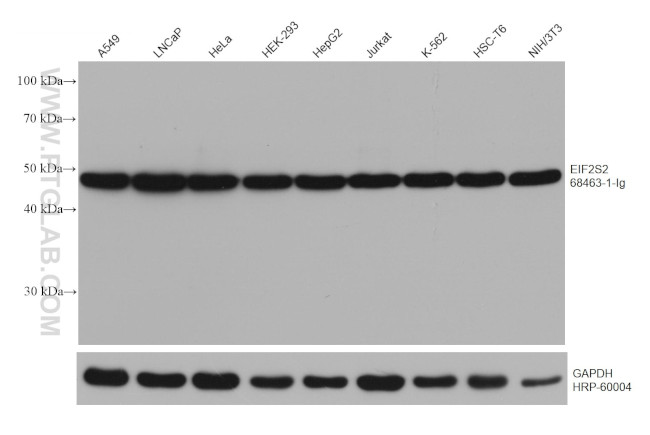EIF2S2 Antibody in Western Blot (WB)