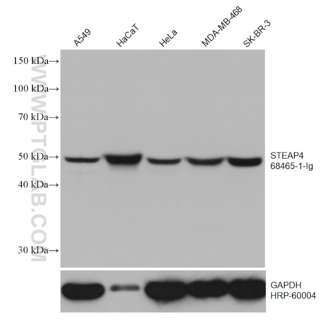 STEAP4 Antibody in Western Blot (WB)