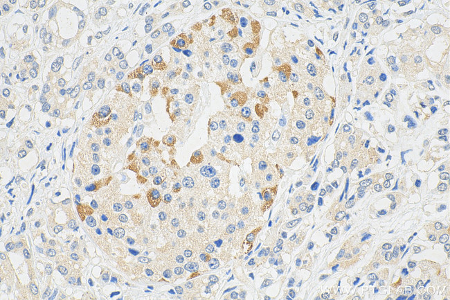 MAOA Antibody in Immunohistochemistry (Paraffin) (IHC (P))