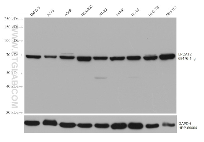 LPCAT2 Antibody in Western Blot (WB)