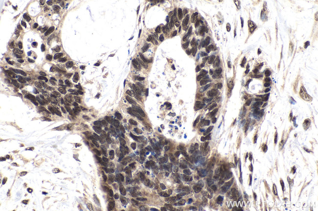 TIA1 Antibody in Immunohistochemistry (Paraffin) (IHC (P))