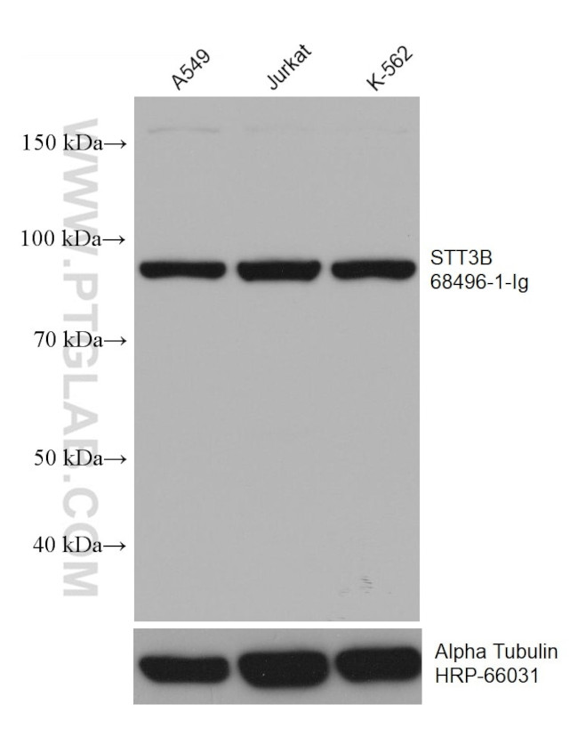 STT3B Antibody in Western Blot (WB)