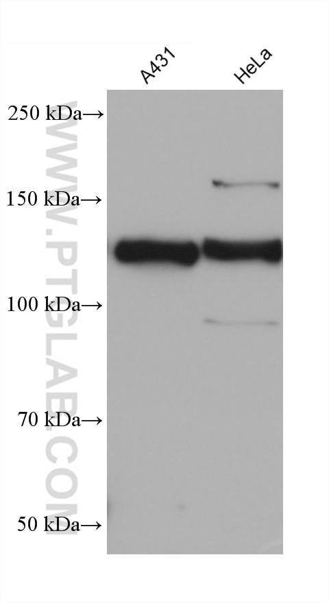 BMPR2 Antibody in Western Blot (WB)