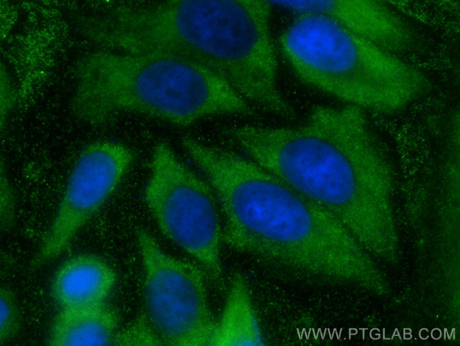 PSPH Antibody in Immunocytochemistry (ICC/IF)