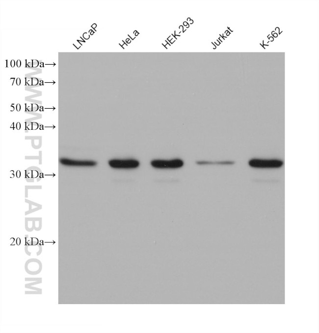 METTL1 Antibody in Western Blot (WB)