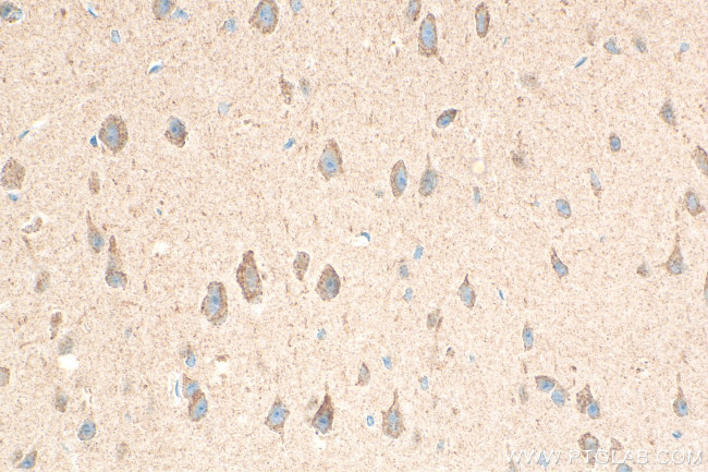 IGFBP5 Antibody in Immunohistochemistry (Paraffin) (IHC (P))