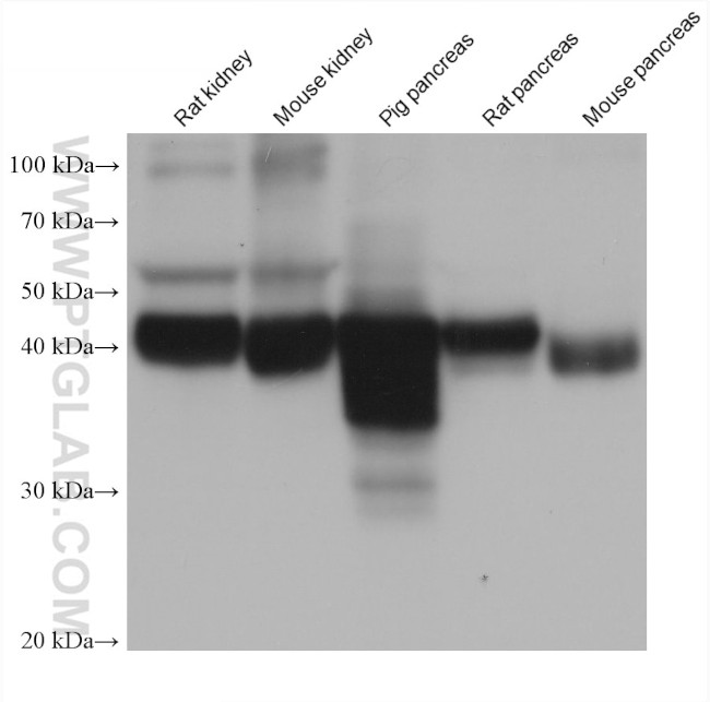 GATM Antibody in Western Blot (WB)