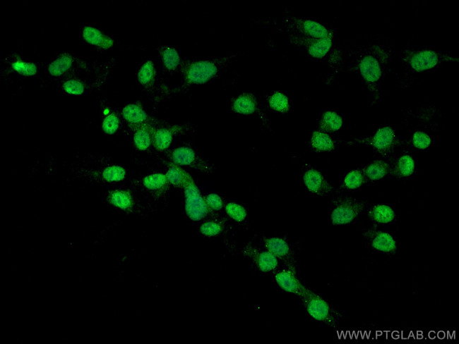 CDK5 Antibody in Immunocytochemistry (ICC/IF)