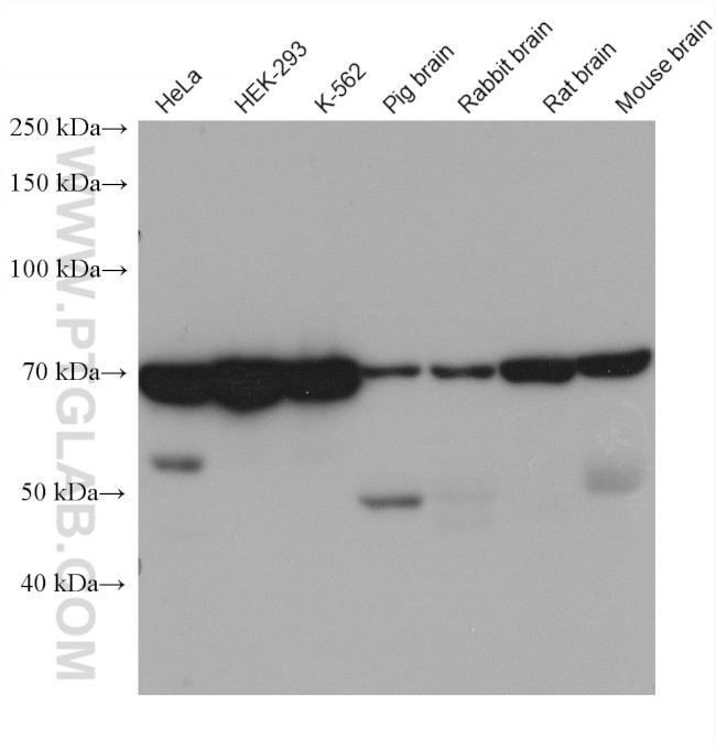 RNF8 Antibody in Western Blot (WB)