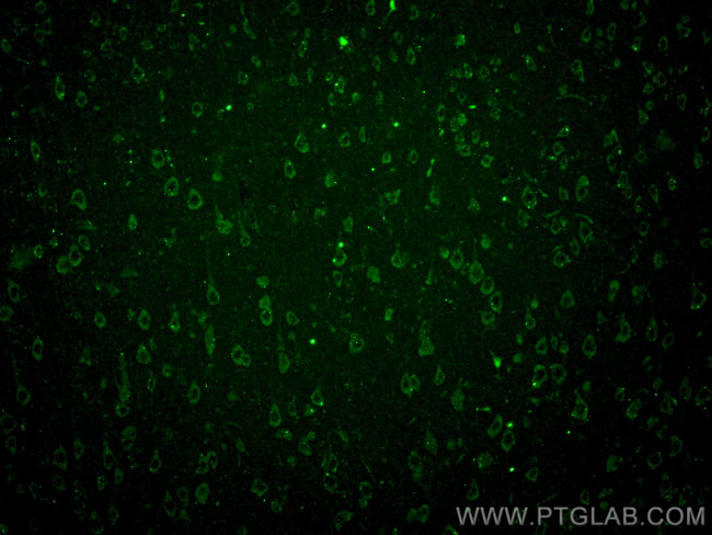 STK24 Antibody in Immunohistochemistry (PFA fixed) (IHC (PFA))