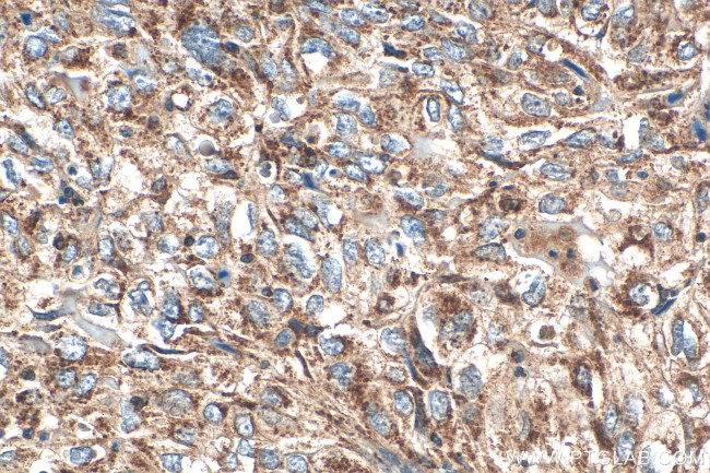 MTHFD2 Antibody in Immunohistochemistry (Paraffin) (IHC (P))