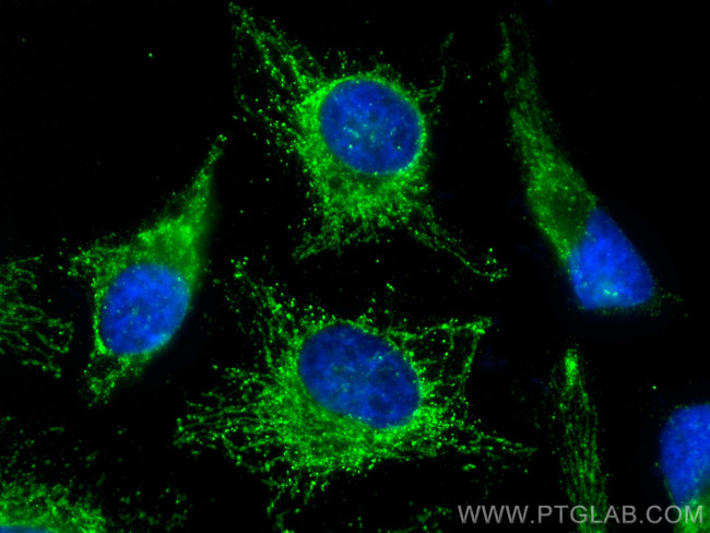 UQCRFS1 Antibody in Immunocytochemistry (ICC/IF)