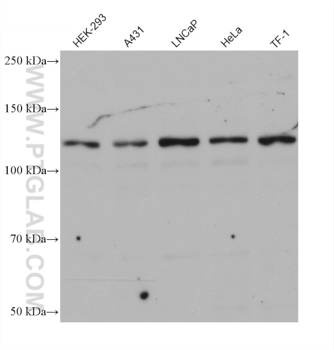 MORC2 Antibody in Western Blot (WB)