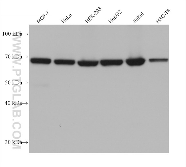 PRMT5 Antibody in Western Blot (WB)