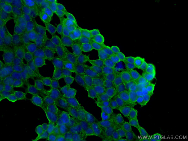 SLC1A5/ASCT2 Antibody in Immunocytochemistry (ICC/IF)