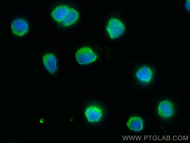 HLA-DRA Antibody in Immunocytochemistry (ICC/IF)