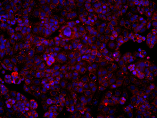 SUCLA2 Antibody in Immunocytochemistry (ICC/IF)