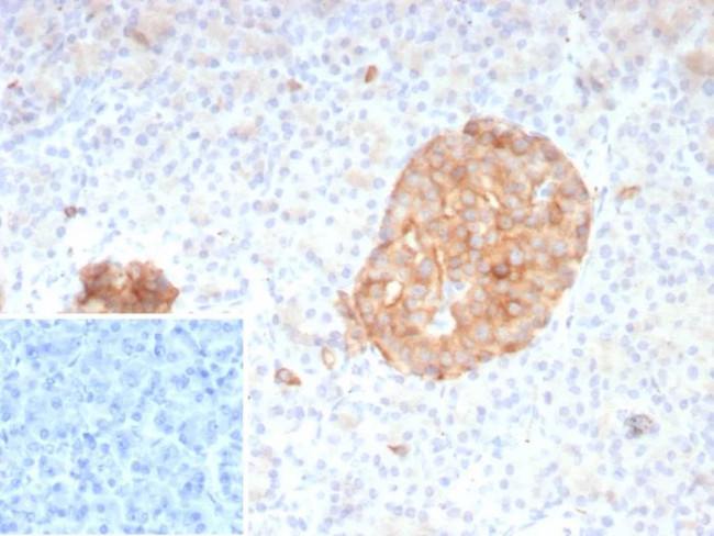Synaptophysin (Neuroendocrine Marker) Antibody in Immunohistochemistry (Paraffin) (IHC (P))