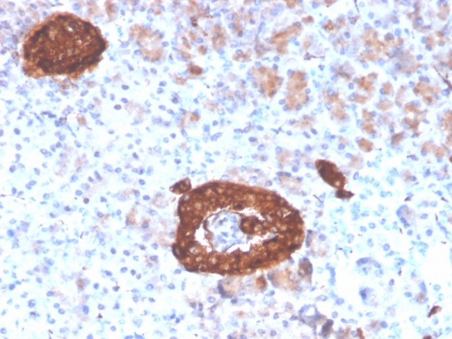 Synaptophysin (Neuroendocrine Marker) Antibody in Immunohistochemistry (Paraffin) (IHC (P))