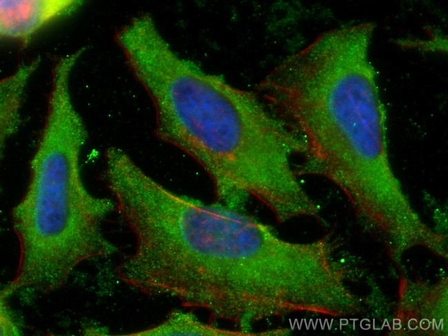 STARD10 Antibody in Immunocytochemistry (ICC/IF)