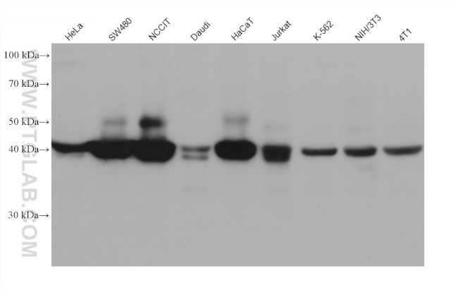 RAD51AP1 Antibody in Western Blot (WB)