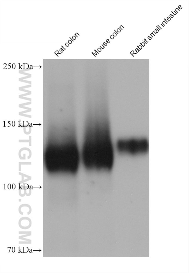 Integrin alpha-5 Antibody in Western Blot (WB)