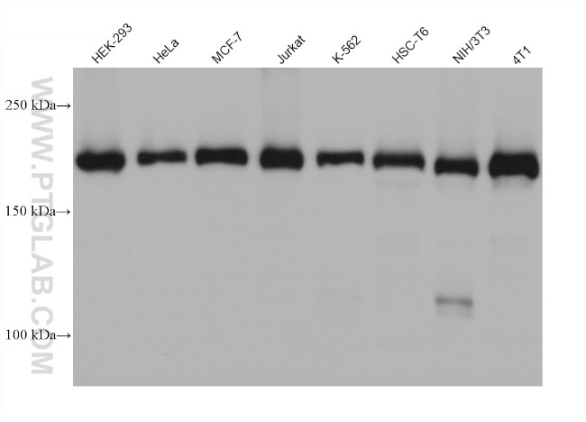 UBR2 Antibody in Western Blot (WB)