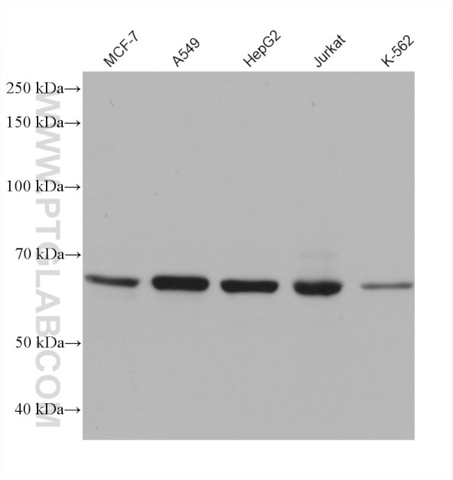 ALAS1 Antibody in Western Blot (WB)