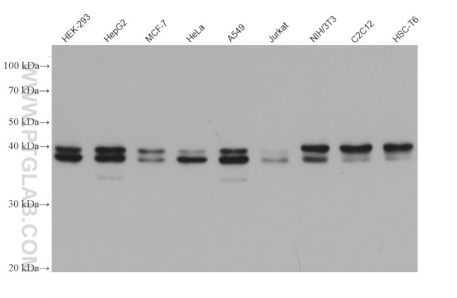 MAP2K3 Antibody in Western Blot (WB)