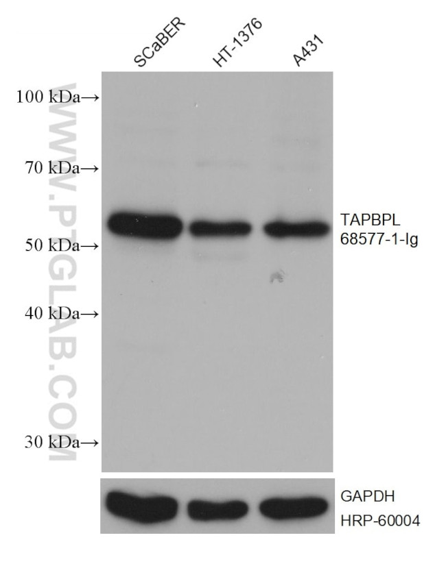 TAPBPL Antibody in Western Blot (WB)