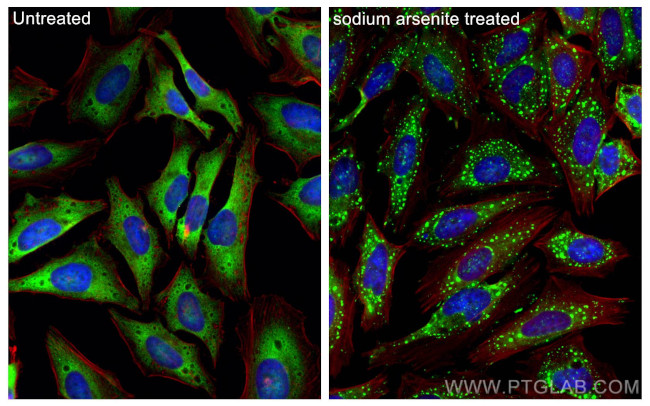 G3BP2 Antibody in Immunocytochemistry (ICC/IF)
