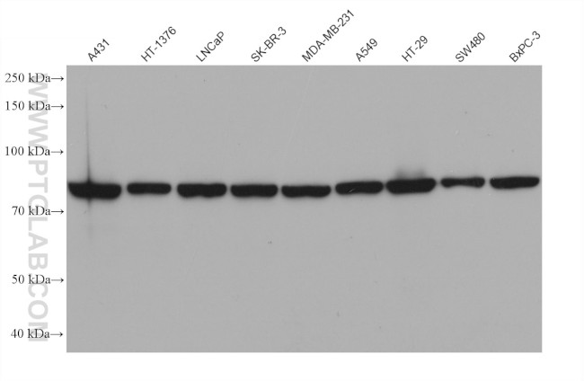 SCNN1A Antibody in Western Blot (WB)