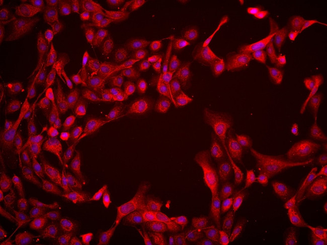 BCAT2 Antibody in Immunocytochemistry (ICC/IF)