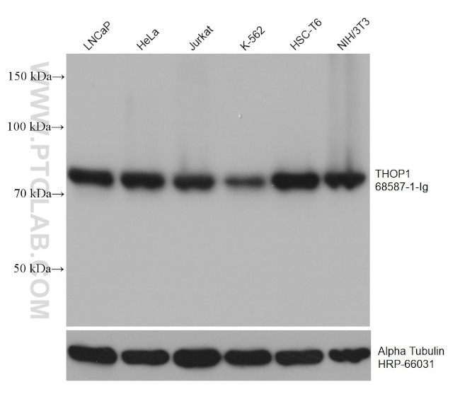 THOP1 Antibody in Western Blot (WB)